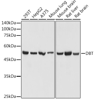 Western blot analysis of extracts of various cell lines using DBT Polyclonal Antibody at 1:1000 dilution.