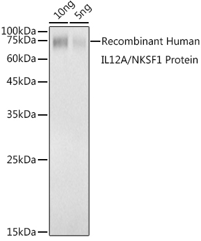 Western blot analysis of extracts of Recombinant Human IL12A/NKSF1 Protein using IL12A Polyclonal Antibody at 1:1000 dilution.