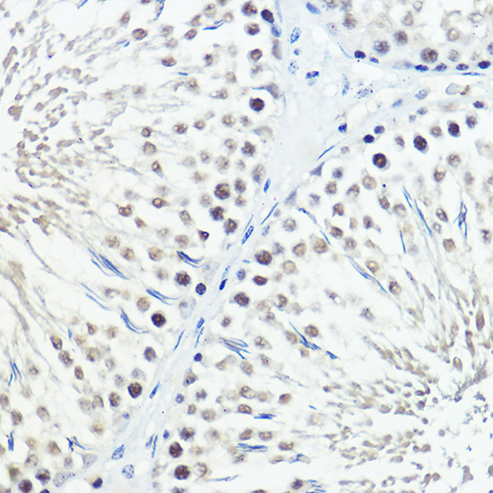 Immunohistochemistry of paraffin-embedded rat testis using Fam221b Polyclonal Antibody at dilution of 1:100 (40x lens).Perform high pressure antigen retrieval with 10 mM citrate buffer pH 6.0 before commencing with IHC staining protocol.