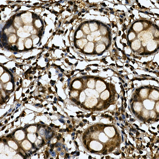 Immunohistochemistry of paraffin-embedded human colon using TNKS1BP1 Polyclonal Antibody atdilution of 1:250 (40x lens).Perform high pressure antigen retrieval with 10 mM citrate buffer pH 6.0 before commencing with IHC staining protocol.