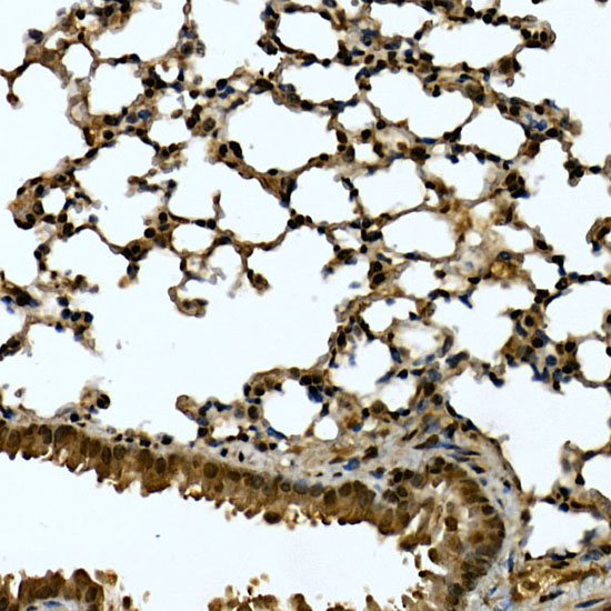 Immunohistochemistry of paraffin-embedded mouse lung using TNKS1BP1 Polyclonal Antibody at dilution of 1:200 (40x lens).Perform high pressure antigen retrieval with 10 mM citrate buffer pH 6.0 before commencing with IHC staining protocol.