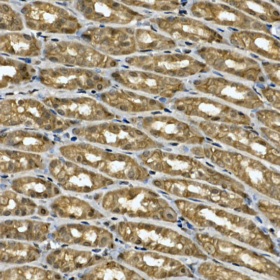 Immunohistochemistry of paraffin-embedded rat stomach using TNKS1BP1 Polyclonal Antibody at dilution of 1:200 (40x lens).Perform high pressure antigen retrieval with 10 mM citrate buffer pH 6.0 before commencing with IHC staining protocol.