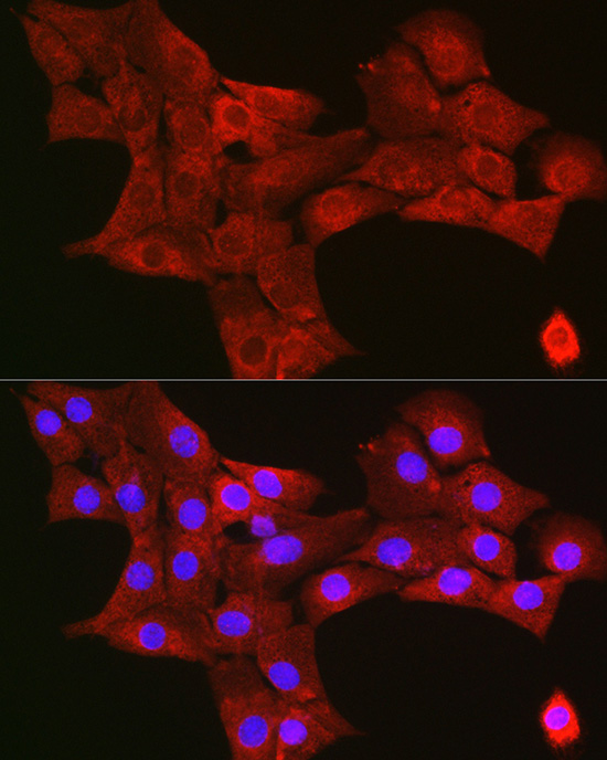 Immunofluorescence analysis of NIH/3T3 cells using TIGAR Polyclonal Antibody at dilution of 1:200 (40x lens). Blue: DAPI for nuclear staining.