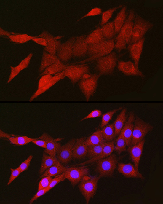 Immunofluorescence analysis of PC-12 cells using TIGAR Polyclonal Antibody at dilution of 1:200 (40x lens). Blue: DAPI for nuclear staining.