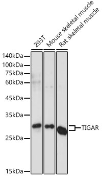 Western blot analysis of extracts of various cell lines using TIGAR Polyclonal Antibody at 1:1000 dilution.