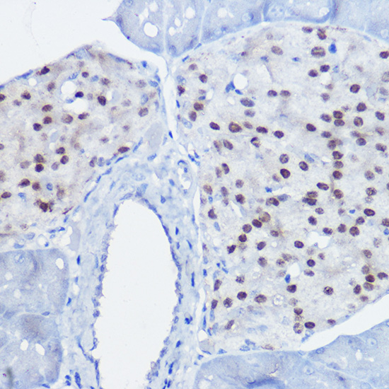 Immunohistochemistry of paraffin-embedded mouse pancreas using NKX6-1 Polyclonal Antibody at dilution of 1:50 (40x lens).Perform high pressure antigen retrieval with 10 mM citrate buffer pH 6.0 before commencing with IHC staining protocol.