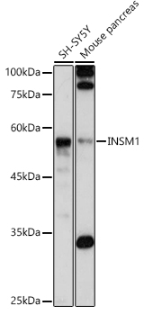 Western blot analysis of extracts of various cell lines using INSM1 Polyclonal Antibody at 1:1000 dilution.