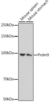 Western blot analysis of extracts of various cell lines using Prdm9 Polyclonal Antibody at 1:1000 dilution.