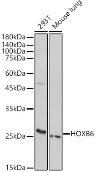 Western blot analysis of extracts of various cell lines using HOXB6 Polyclonal Antibody at 1:1000 dilution.