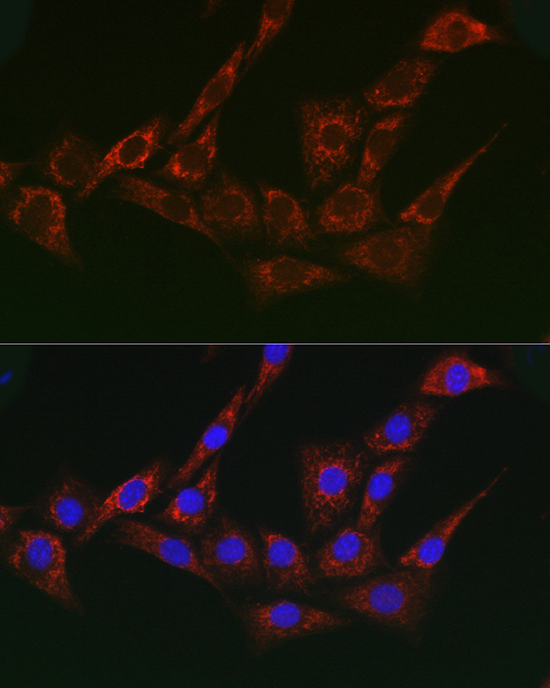 Immunofluorescence analysis of NIH/3T3 cells using AP1G1 Polyclonal Antibody at dilution of 1:200 (40x lens). Blue: DAPI for nuclear staining.