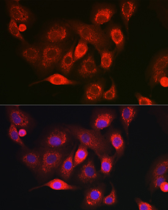 Immunofluorescence analysis of A-549 cells using NDUFB8 Polyclonal Antibody at dilution of 1:100 (40x lens). Blue: DAPI for nuclear staining.