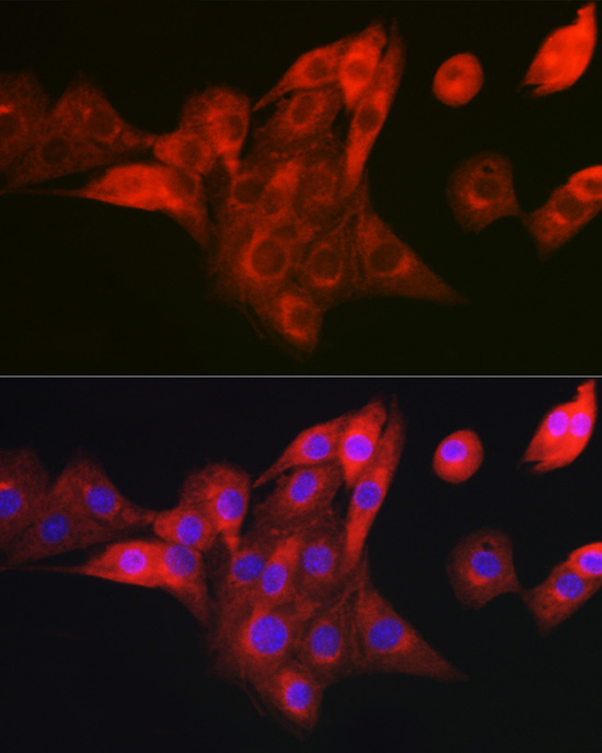 Immunofluorescence analysis of NIH/3T3 cells using NDUFB8 Polyclonal Antibody at dilution of 1:100 (40x lens). Blue: DAPI for nuclear staining.