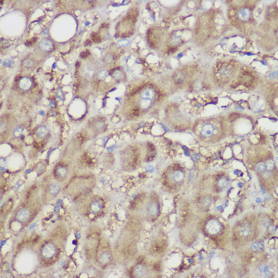 Immunohistochemistry of paraffin-embedded human liver using NDUFB8 Polyclonal Antibody at dilution of 1:100 (40x lens).Perform high pressure antigen retrieval with 10 mM citrate buffer pH 6.0 before commencing with IHC staining protocol.