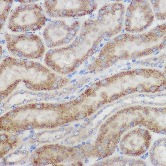 Immunohistochemistry of paraffin-embedded mouse kidney using NDUFB8 Polyclonal Antibody at dilution of 1:100 (40x lens).Perform high pressure antigen retrieval with 10 mM citrate buffer pH 6.0 before commencing with IHC staining protocol.