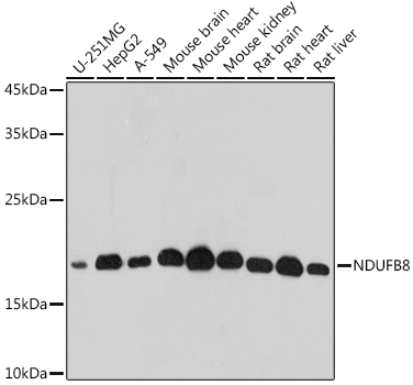 Western blot analysis of extracts of various cell lines using NDUFB8 Polyclonal Antibody at 1:500 dilution.