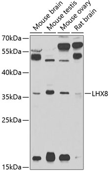 Western blot analysis of extracts of various cell lines using LHX8 Polyclonal Antibody at 1:1000 dilution.