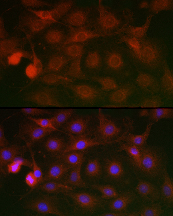 Immunofluorescence analysis of C6 cells using SSR2 Polyclonal Antibody at dilution of 1:100 (40x lens). Blue: DAPI for nuclear staining.