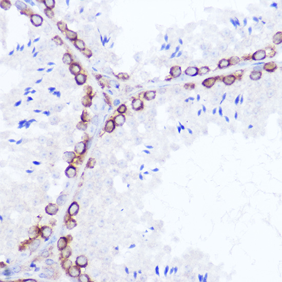 Immunohistochemistry of paraffin-embedded rat testis using SSR2 Polyclonal Antibody at dilution of 1:100 (40x lens).Perform high pressure antigen retrieval with 10 mM citrate buffer pH 6.0 before commencing with IHC staining protocol.