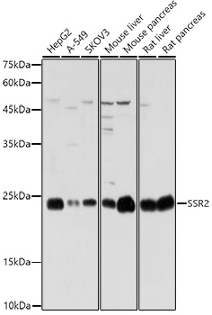 Western blot analysis of extracts of various cell lines using SSR2 Polyclonal Antibody at 1:1000 dilution.