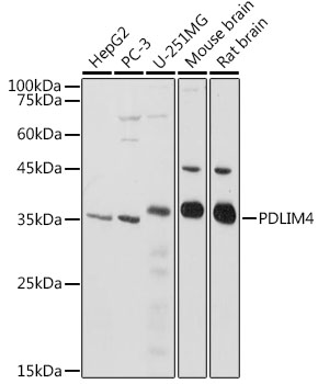 Western blot analysis of extracts of various cell lines using PDLIM4 Polyclonal Antibody at 1:1000 dilution.