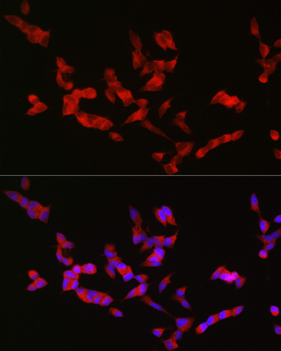 Immunofluorescence analysis of SH-SY5Y cells using BSN Polyclonal Antibody at dilution of 1:50 (40x lens). Blue: DAPI for nuclear staining.