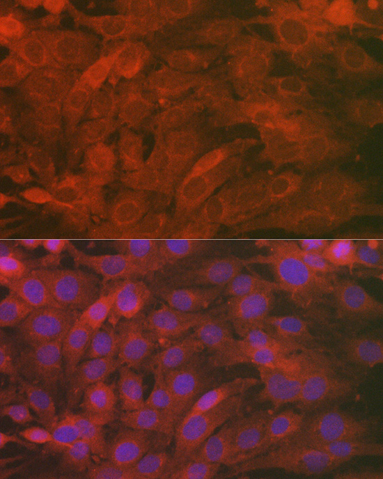 Immunofluorescence analysis of C6 cells using SCRN1 Polyclonal Antibody at dilution of 1:100 (40x lens). Blue: DAPI for nuclear staining.