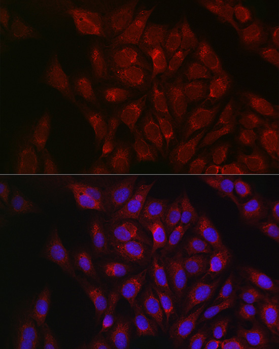 Immunofluorescence analysis of U2OS cells using RBCK1 Polyclonal Antibody at dilution of 1:100. Blue: DAPI for nuclear staining.