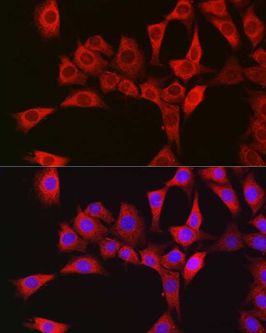 Immunofluorescence analysis of NIH/3T3 cells using RBCK1 Polyclonal Antibody at dilution of 1:100. Blue: DAPI for nuclear staining.