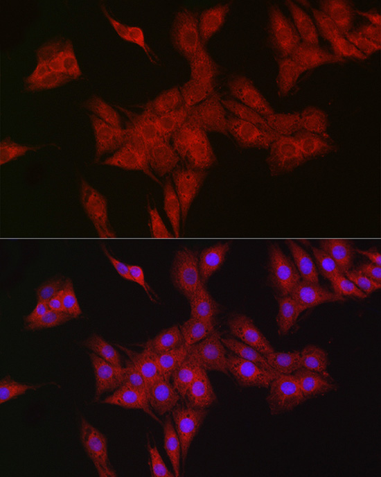 Immunofluorescence analysis of PC-12 cells using RBCK1 Polyclonal Antibody at dilution of 1:100. Blue: DAPI for nuclear staining.