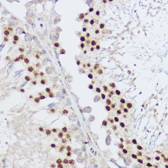 Immunohistochemistry of paraffin-embedded rat testis using KLF12 Polyclonal Antibody at dilution of 1:100 (40x lens).Perform high pressure antigen retrieval with 10 mM citrate buffer pH 6.0 before commencing with IHC staining protocol.