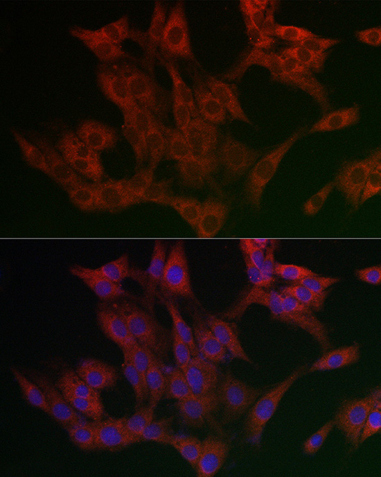 Immunofluorescence analysis of PC-12 cells using FAF2 Polyclonal Antibody at dilution of 1:200 (40x lens). Blue: DAPI for nuclear staining.