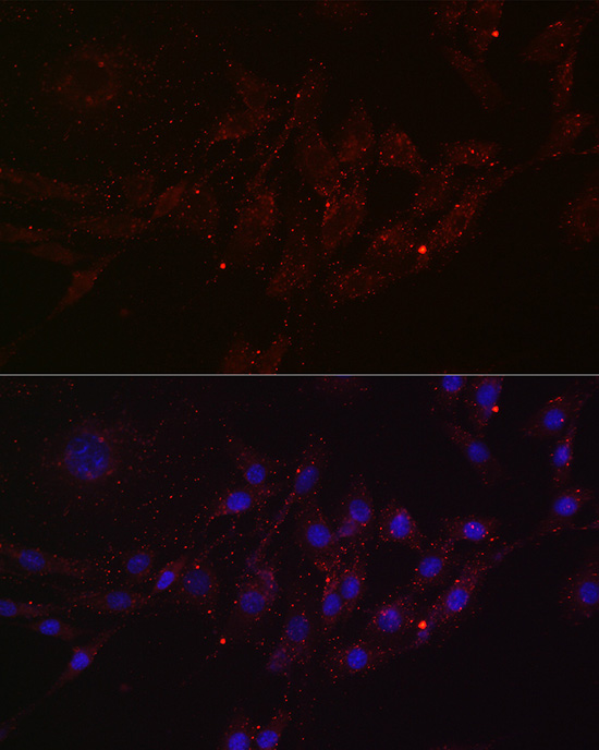 Immunofluorescence analysis of NIH/3T3 cells using MGRN1 Polyclonal Antibody at dilution of 1:100 (40x lens). Blue: DAPI for nuclear staining.