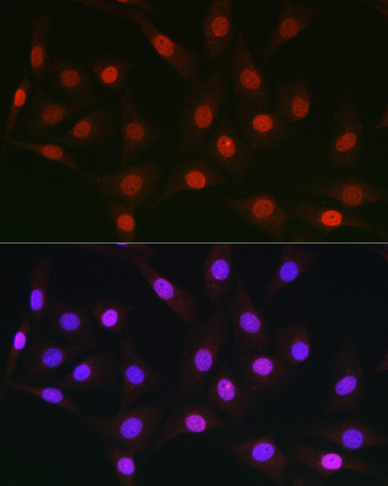 Immunofluorescence analysis of NIH/3T3 cells using AUTS2 Polyclonal Antibody at dilution of 1:50 (40x lens). Blue: DAPI for nuclear staining.