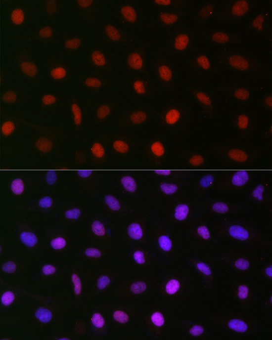 Immunofluorescence analysis of U2OS cells using AUTS2 Polyclonal Antibody at dilution of 1:50 (40x lens). Blue: DAPI for nuclear staining.