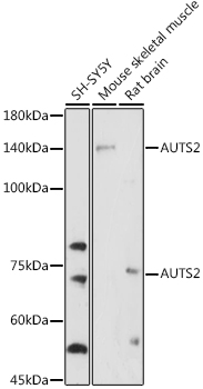 Western blot analysis of extracts of various cell lines using AUTS2 Polyclonal Antibody at 1:1000 dilution.