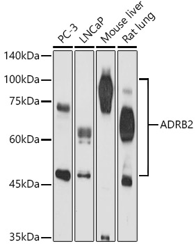 Western blot analysis of extracts of various cell lines using ADRB2 Polyclonal Antibody at 1:500 dilution.