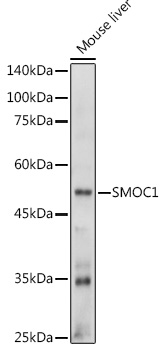 Western blot analysis of extracts of Mouse liver using SMOC1 Polyclonal Antibody at 1:1000 dilution.