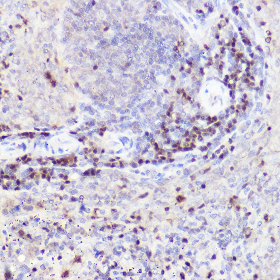 Immunohistochemistry of paraffin-embedded rat spleen using CTIP2/BCL11B Polyclonal Antibody at dilution of 1:50 (40x lens).Perform high pressure antigen retrieval with 10 mM citrate buffer pH 6.0 before commencing with IHC staining protocol.