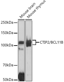 Western blot analysis of extracts of various cell lines using CTIP2/BCL11B Polyclonal Antibody at 1:1000 dilution.