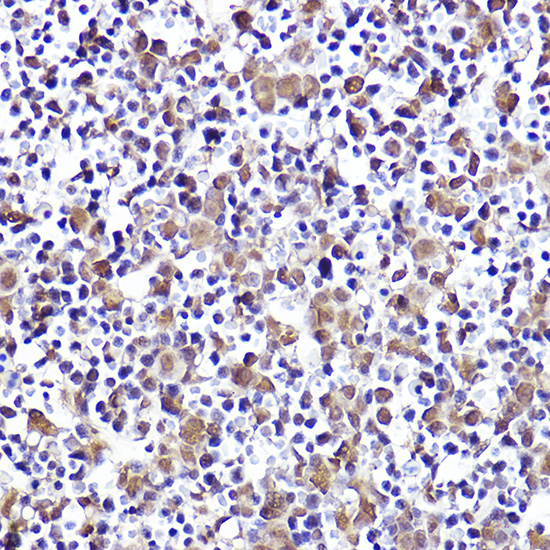 Immunohistochemistry of paraffin-embedded mouse fetal liver using CMIP Polyclonal Antibody at dilution of 1:50 (40x lens).Perform high pressure antigen retrieval with 10 mM citrate buffer pH 6.0 before commencing with IHC staining protocol.