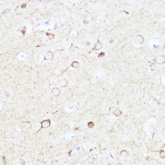 Immunohistochemistry of paraffin-embedded human brain using SHANK3 Polyclonal Antibody at dilution of 1:100 (40x lens).Perform high pressure antigen retrieval with 10 mM citrate buffer pH 6.0 before commencing with IHC staining protocol.