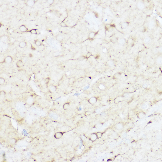 Immunohistochemistry of paraffin-embedded rat brain using SHANK3 Polyclonal Antibody at dilution of 1:100 (40x lens).Perform high pressure antigen retrieval with 10 mM citrate buffer pH 6.0 before commencing with IHC staining protocol.