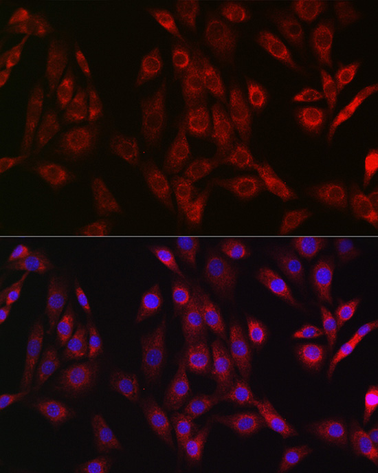 Immunofluorescence analysis of NIH/3T3 cells using OTULIN Polyclonal Antibody at dilution of 1:50 (40x lens). Blue: DAPI for nuclear staining.