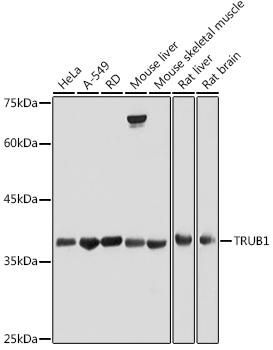 Western blot analysis of extracts of various cell lines using TRUB1 Polyclonal Antibody at 1:500 dilution.