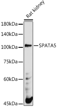 Western blot analysis of extracts of Rat kidney using SPATA5 Polyclonal Antibody at 1:500 dilution.