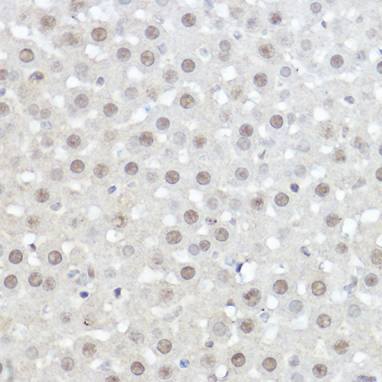 Immunohistochemistry of paraffin-embedded Mouse liver using AHNAK Polyclonal Antibody at dilution of 1:50 (40x lens).1.Perform high pressure antigen retrieval with 10 mM citrate buffer pH 6.0 before commencing with IHC staining protocol.