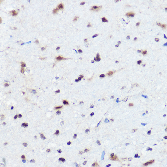 Immunohistochemistry of paraffin-embedded Mouse brain using AHNAK Polyclonal Antibody at dilution of 1:50 (40x lens).1.Perform high pressure antigen retrieval with 10 mM citrate buffer pH 6.0 before commencing with IHC staining protocol.