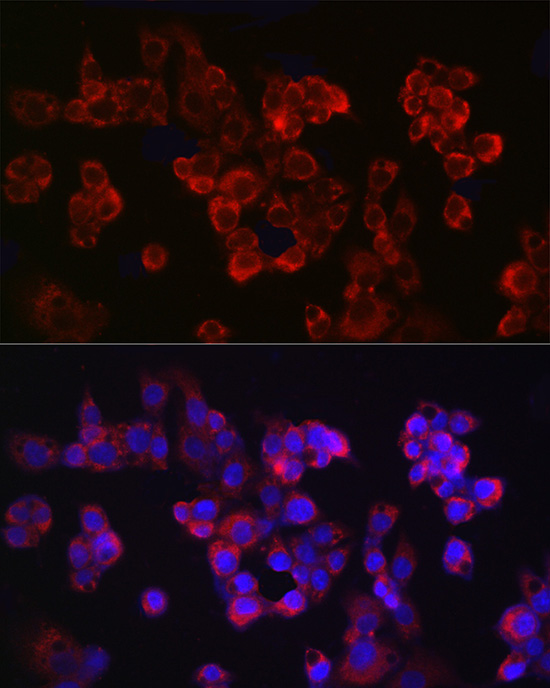 Immunofluorescence analysis of HepG2 cells using APP Polyclonal Antibody atdilution of 1:100 (40x lens). Blue: DAPI for nuclear staining.