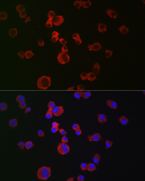 Immunofluorescence analysis of Neuro-2a cells using APP Polyclonal Antibody at dilution of 1:100 (40x lens). Blue: DAPI for nuclear staining.