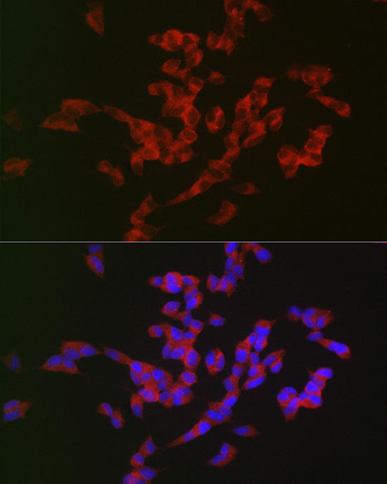 Immunofluorescence analysis of SH-SY5Y cells using APP Polyclonal Antibody at dilution of 1:100 (40x lens). Blue: DAPI for nuclear staining.